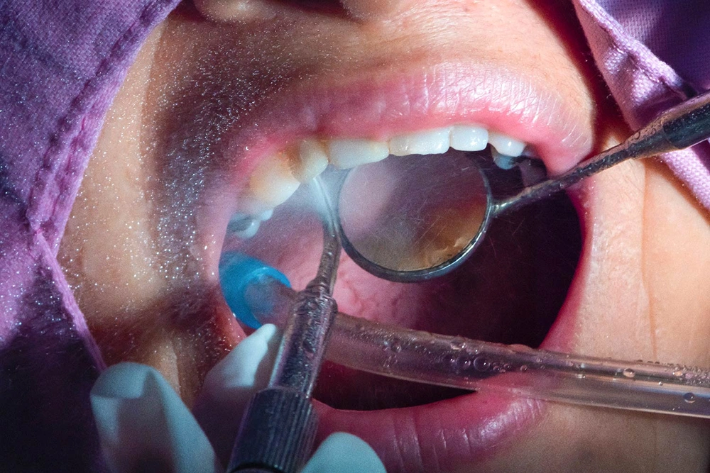 Mortillaro Igiene 2 Tablet